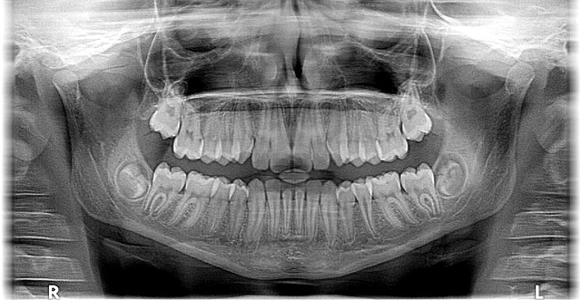 rentgen lidské čelisti.jpg